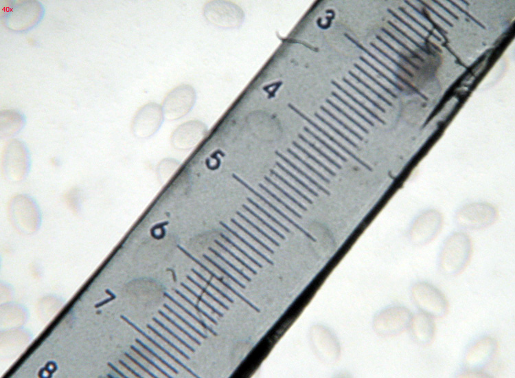 Su bruciato (cfr. Pyronema sp.)